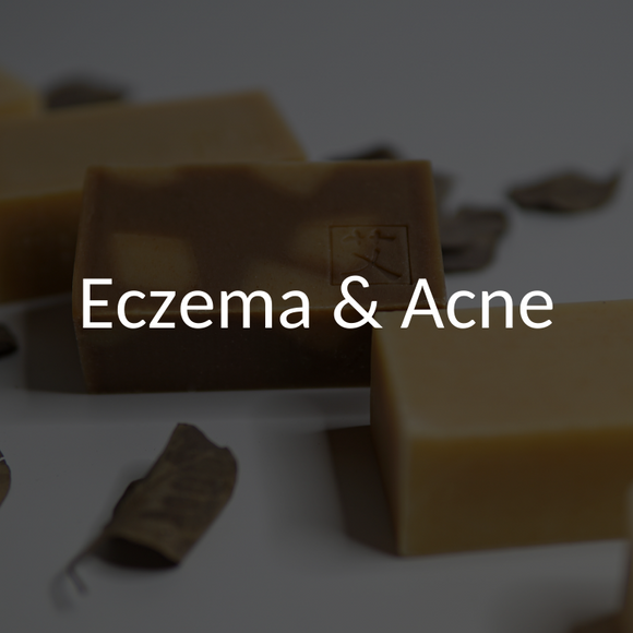 handmade-soap-for-eczema-acne